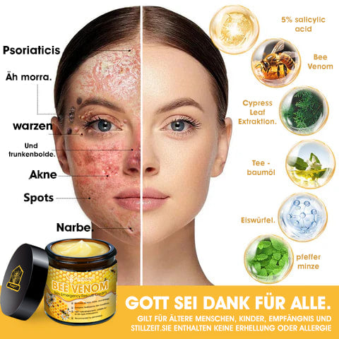 Tnnedey™ Bienengift Haut-Notfall-Rettungscreme (AAD empfohlen) 💆♀️ (Expertenempfehlung)