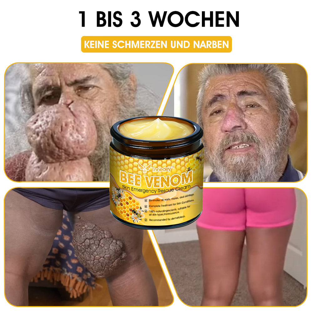 Tnnedey™ Bienengift Haut-Notfall-Rettungscreme (AAD empfohlen) 💆♀️ (Expertenempfehlung)
