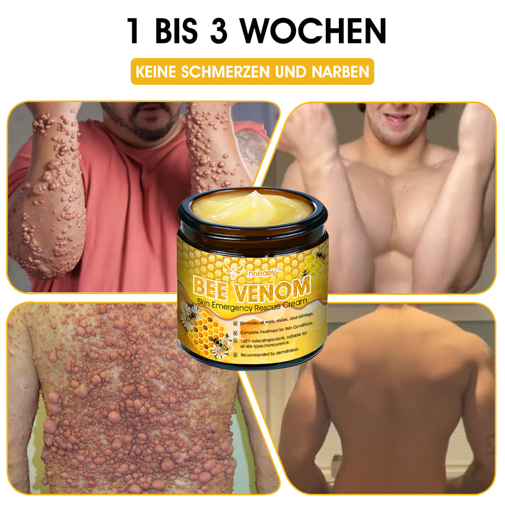 Tnnedey™ Bienengift Haut-Notfall-Rettungscreme (AAD empfohlen) 💆♀️ (Expertenempfehlung)