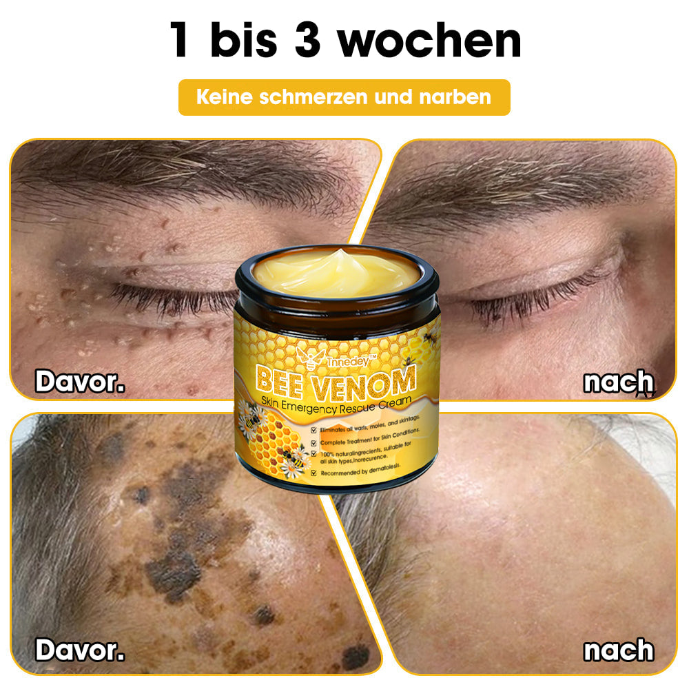 Tnnedey™ Bienengift Haut-Notfall-Rettungscreme (AAD empfohlen) 💆♀️ (Expertenempfehlung)