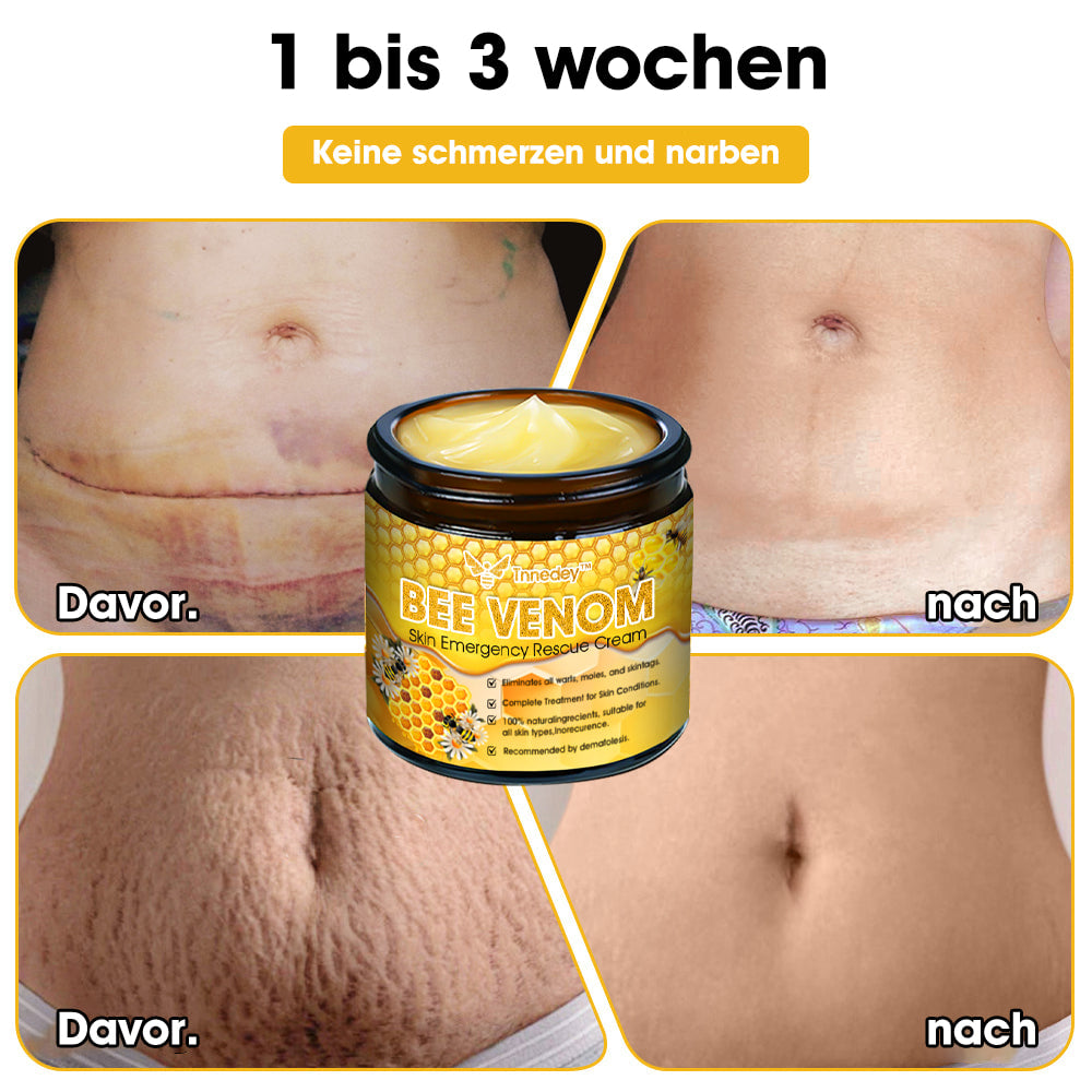 Tnnedey™ Bienengift Haut-Notfall-Rettungscreme (AAD empfohlen) 💆♀️ (Expertenempfehlung)