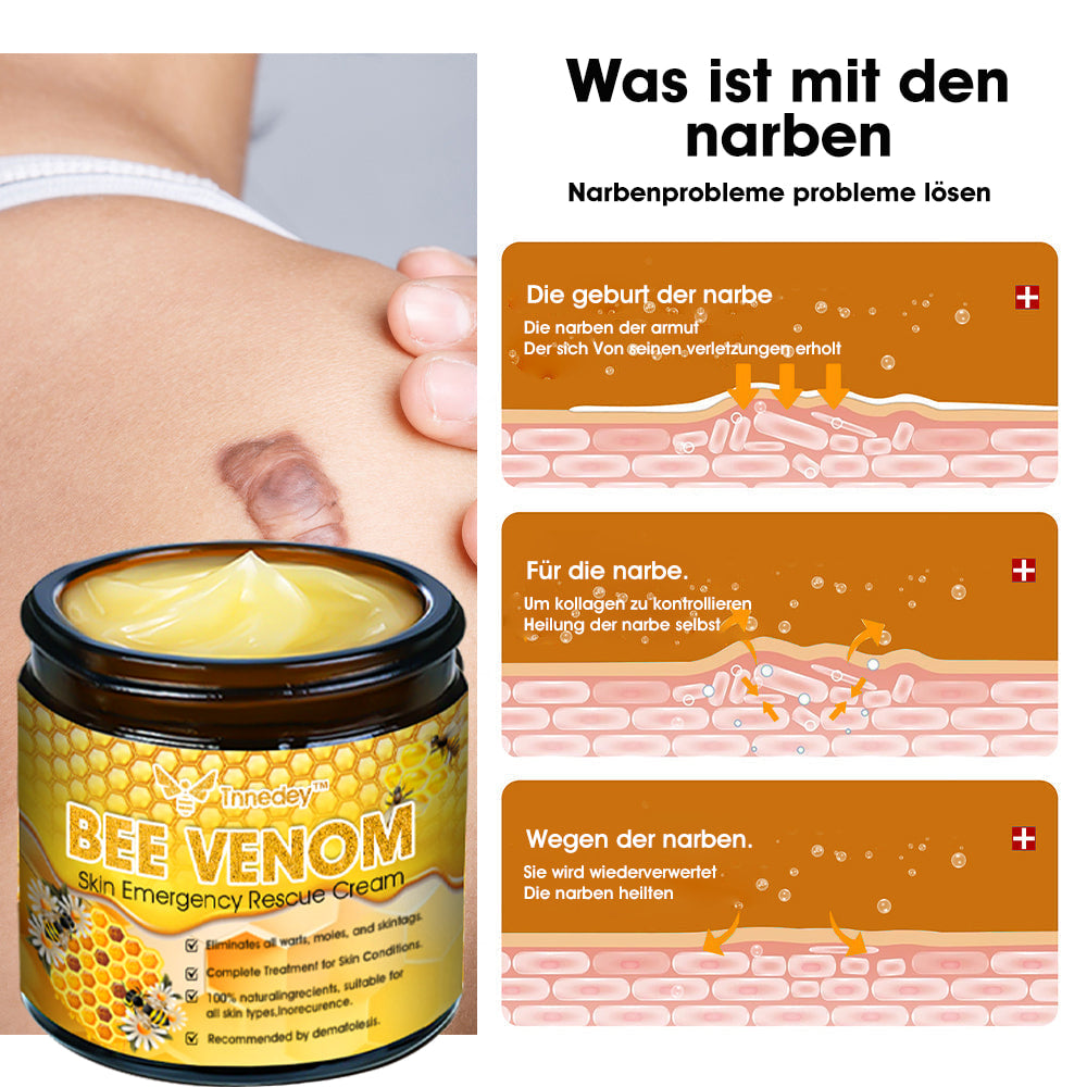 Tnnedey™ Bienengift Haut-Notfall-Rettungscreme (AAD empfohlen) 💆♀️ (Expertenempfehlung)