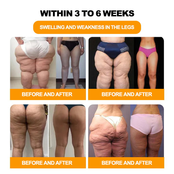 Tnnedey® 🏆✨30-Kräuter Slimming & Detox Fußbadekugeln - ❤️👩⚕️ (BDL-Bundesverband Deutscher Lymphologen e.V.)