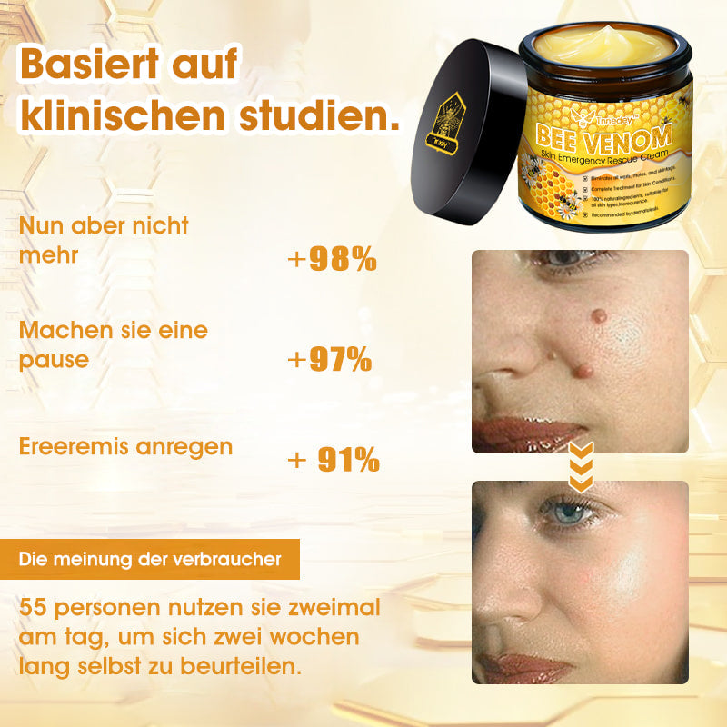 Tnnedey™ Bienengift Haut-Notfall-Rettungscreme (AAD empfohlen) 💆♀️ (Expertenempfehlung)