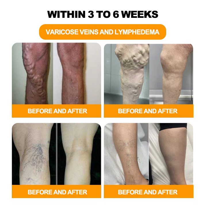 Tnnedey® 🏆✨30-Kräuter Slimming & Detox Fußbadekugeln - ❤️👩⚕️ (BDL-Bundesverband Deutscher Lymphologen e.V.)